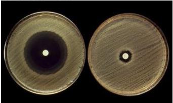 Staphylococcus aureus